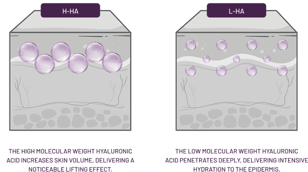 Benefits illustration