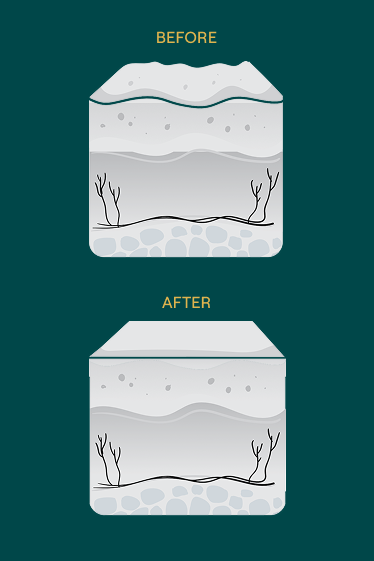 Treatment protocol step one